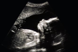 article_images/abortion_a_biblical_view_634942227.jpg